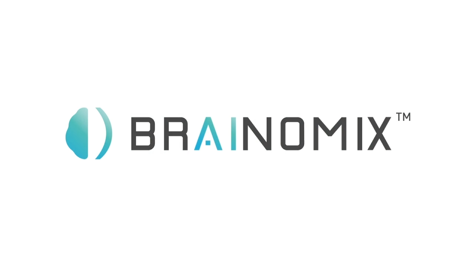 brainomix video vimeo
